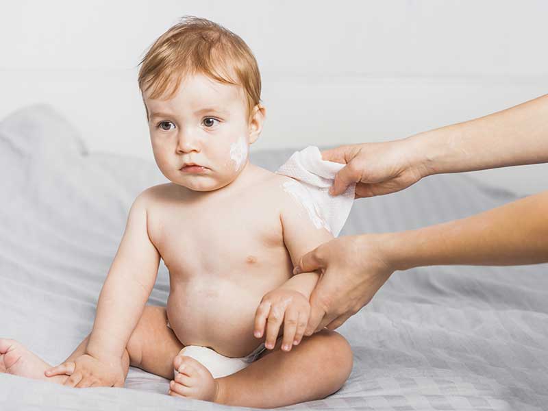 Kulit Bayi Ruam Dikasih Apa?